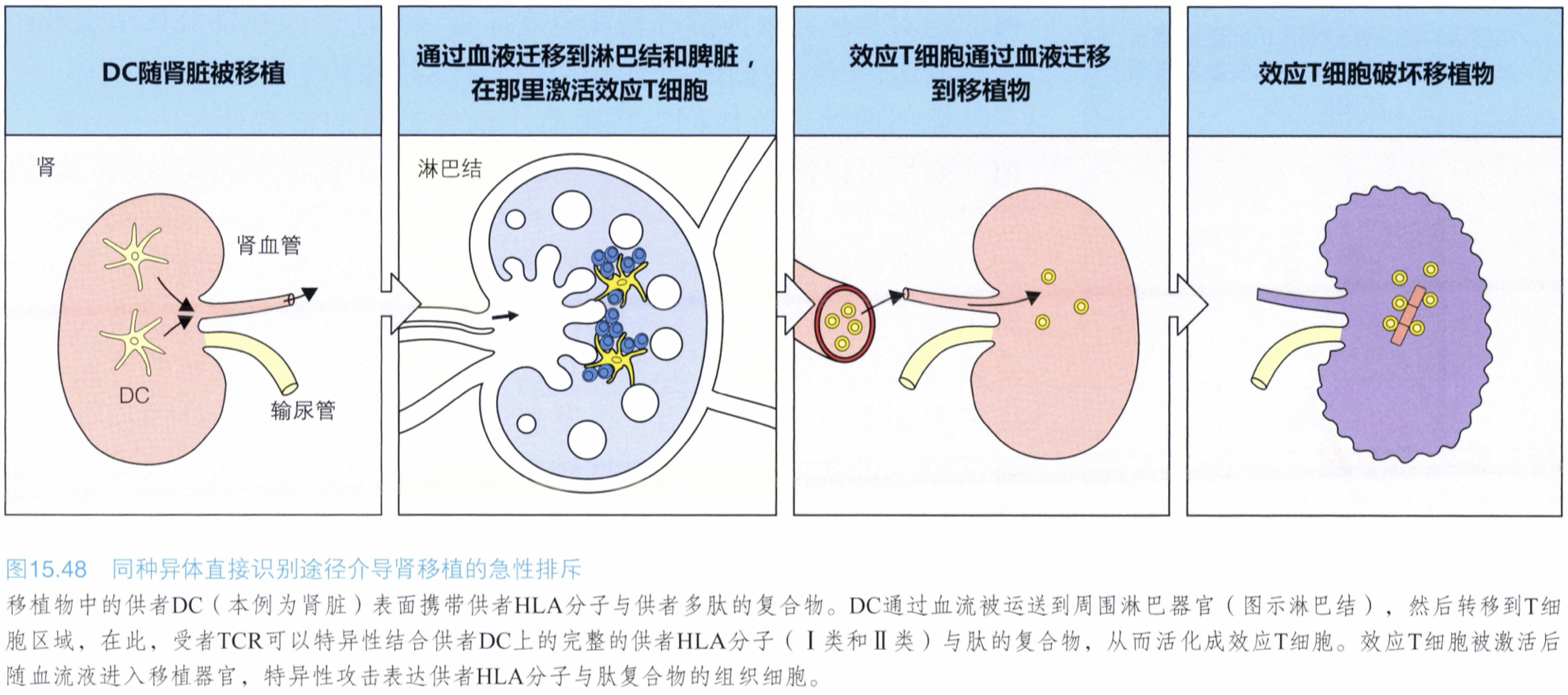 attachment/直接识别.png